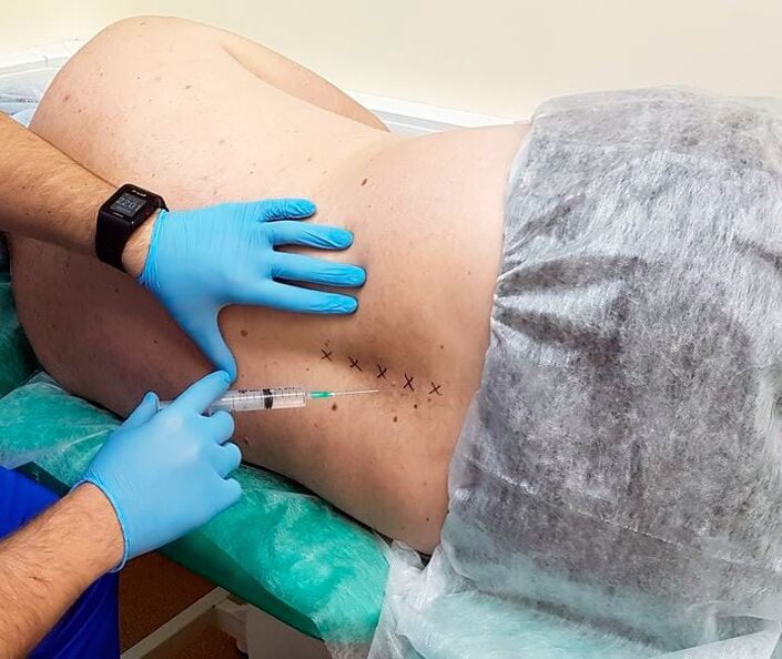 blocchi medicinali per la schiena