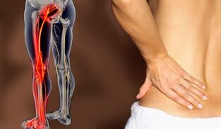 Caratteristiche del mal di schiena