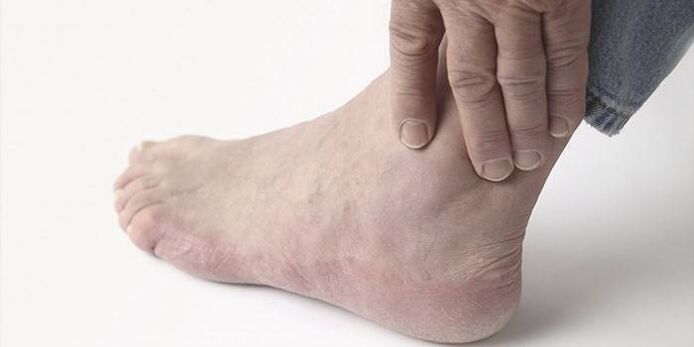dolore nell'artrosi della caviglia